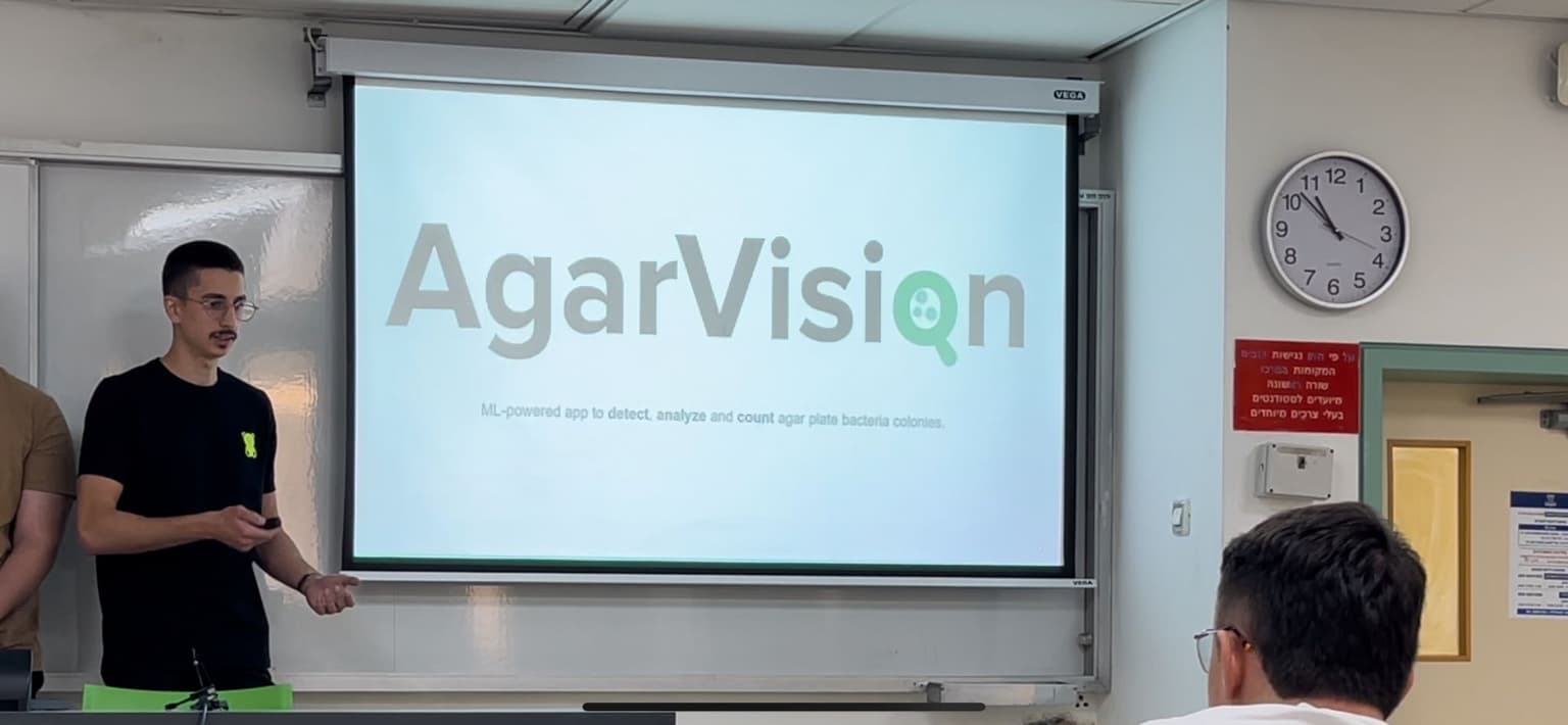 AgarVision